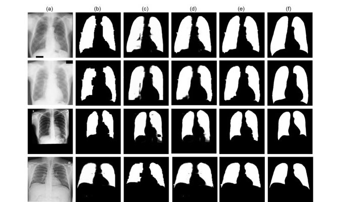Collection of MRI images of the lungs arranged in a grid.