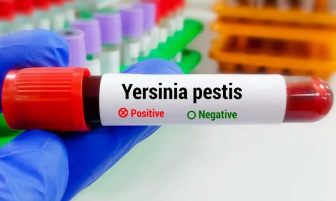 Gloved hand holding a blood sample tube labeled “Yersinia pestis,” with “Positive” marked and “Negative” unmarked; laboratory test tubes and racks are visible in the background.